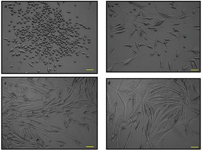 Lipopolysaccharide Pre-conditioning Attenuates Pro-inflammatory Responses and Promotes Cytoprotective Effect in Differentiated PC12 Cell Lines via Pre-activation of Toll-Like Receptor-4 Signaling Pathway Leading to the Inhibition of Caspase-3/Nuclear Factor-κappa B Pathway